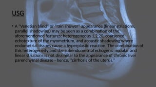 USG
• A "Venetian blind" or "rain shower" appearance (linear striations,
parallel shadowing) may be seen as a combination of the
aforementioned features: heterogeneous 1,2,20, coarsened
echotexture of the myometrium, and acoustic shadowing where
endometrial tissues cause a hyperplastic reaction. The combination of
this heterogeneity and the subendometrial echogenic nodular and
linear striations is not dissimilar to the appearance of chronic liver
parenchymal disease - hence, “cirrhosis of the uterus.”
 