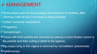  MANAGEMENT:
• Small polyps such as mucus polyps are removed by twisting ,after
catching it with an ALLI”s forceps or tissue forceps.
• Certain hormonal medications
Progestins.
Gonadotropin.
Polyps with thick pedicle are removed by placing a trans fixation suture in
the pedicle and then cutting it distal to the ligature.
Big polyps lying in the vagina is removed by morcellation (piecemeal).
Hysteroscopy.
 