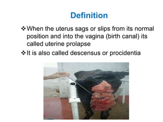 Definition
When the uterus sags or slips from its normal
position and into the vagina (birth canal) its
called uterine prolapse
It is also called descensus or procidentia
 