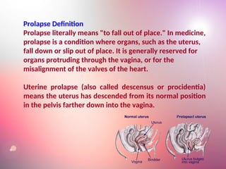 uterine prolapse in displacement final.ppt