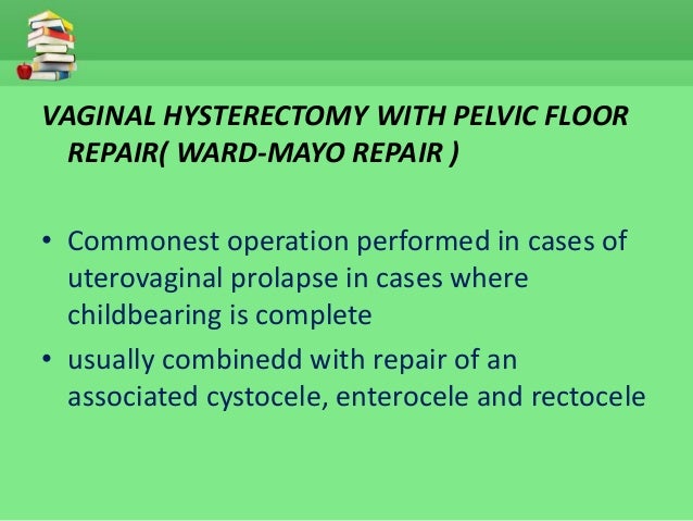 Uterine Prolapse Management