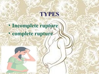 Uterine rupture | PPT
