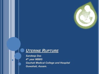 UTERINE RUPTURE
Sandeep Das
4th year MBBS
Gauhati Medical College and Hospital
Guwahati, Assam.
 