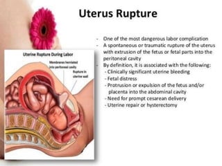 Comprehensive Overview of Uterine Rupture: Causes, Risks, and ...