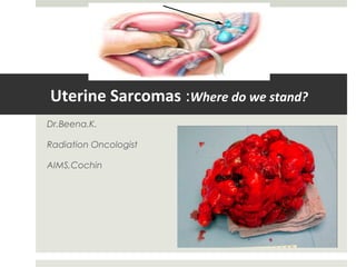 Uterine Sarcomas :Where do we stand?
Dr.Beena.K.
Radiation Oncologist
AIMS,Cochin
 