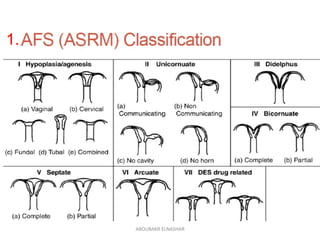 Uterine septum ASRM GUIDELINES2016 | PPSX