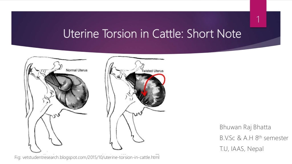 Uterine torsion
