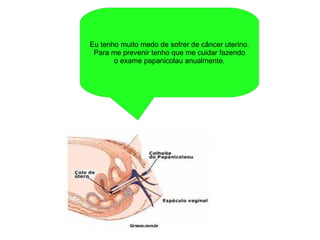 Eu tenho muito medo de sofrer de câncer uterino. Para me prevenir tenho que me cuidar fazendo o exame papanicolau anualmente. 