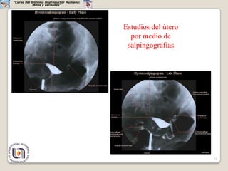“Curso del Sistema Reproductor Humano:
            Mitos y verdades”




                                         Estudios del útero
                                           por medio de
                                          salpingografías




                                                              18
 