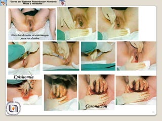 “Curso del Sistema Reproductor Humano:
            Mitos y verdades”




 Haz click derecho en esta imagen
         para ver el video




   Episitomía




                                         Coronación
                                                      39
 