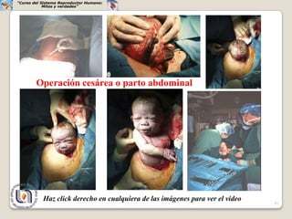 “Curso del Sistema Reproductor Humano:
            Mitos y verdades”




        Operación cesárea o parto abdominal




           Haz click derecho en cualquiera de las imágenes para ver el video   43
 