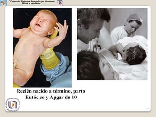 “Curso del Sistema Reproductor Humano:
            Mitos y verdades”




      Recién nacido a término, parto
         Eutócico y Apgar de 10

                                         45
 
