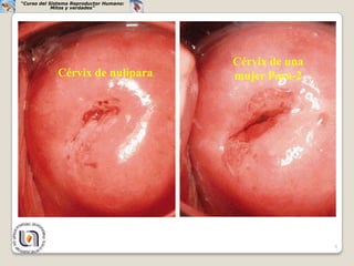 “Curso del Sistema Reproductor Humano:
            Mitos y verdades”




                                         Cérvix de una
             Cérvix de nulípara          mujer Para-2




                                                         9
 