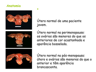 Anatomia
           


           Útero normal de uma paciente
           jovem.

           Útero normal na perimenopausa:
           os ovários são menores do que os
           anteriores de cor acastanhada e
           aparência bosselada.


           Útero normal na pós-menopausa:
           útero e ovários são menores do que o
           anterior e têm aparência
           brancascenta.
 