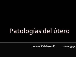 Lorena Calderón E. 100145954
 