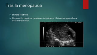 Tras la menopausia
 El útero se atrofia
 Disminución rápida de tamaño en los primeros 10 años que sigue al cese
de la menstruación.
 