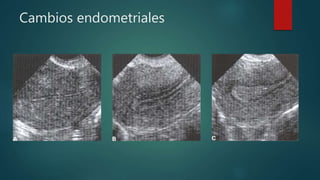 Cambios endometriales
 
