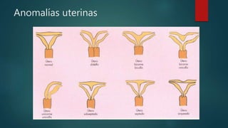 Anomalías uterinas
 