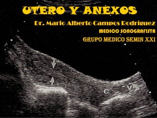 UTERO Y ANEXOS
Dr. Mario Alberto Campos RodríguezDr. Mario Alberto Campos Rodríguez
MEDICO SONOGRAFISTA
GRUPO MEDICO SEMIN XXI
 