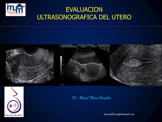 Dr. Romel Flores Virgilio
EVALUACION
ULTRASONOGRAFICA DEL UTERO
 