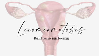 Leiomiomatosis
María Fernanda Villa Domínguez
 