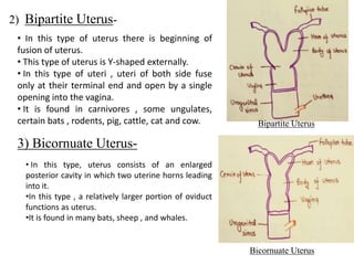 Uterus Modification pptx Uterus Modification pptx