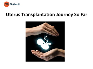 Uterus Transplantation Journey So Far
 