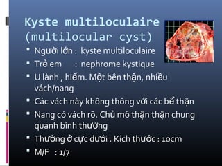 Kyste multiloculaire
(multilocular cyst)
 Ng i l n : kyste multiloculaireườ ớ
 Tr em : nephrome kystiqueẻ
 U lành , hi m. M t bên th n, nhi uế ộ ậ ề
vách/nang
 Các vách này không thông v i các b th nớ ể ậ
 Nang có vách rõ. Ch mô th n th n chungủ ậ ậ
quanh bình th ngườ
 Th ng c c d i . Kích th c : 10cmườ ở ự ướ ướ
 M/F : 1/7
 
