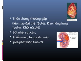  Tri u ch ng th ng g p :ệ ứ ườ ặ
ti u máu đ i th (60%). Đau hông l ngể ạ ể ư
(40%). Kh i u(40%)ố
 S t nh , s t cân,ố ẹ ụ
 Thi u máu, tăng calci máuế
 30% phát hi n tình cệ ờ
 