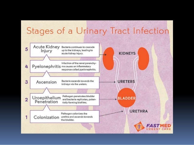 Urinary Tract Infections