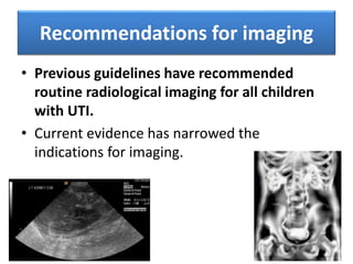 Recommendations for imaging
• Previous guidelines have recommended
routine radiological imaging for all children
with UTI.
• Current evidence has narrowed the
indications for imaging.
 