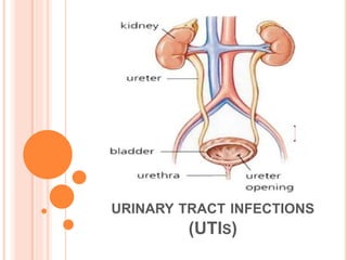 URINARY TRACT INFECTIONS
(UTIS)
 