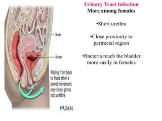 Urinary Tract Infection
More among females
•Short urethra
•Close proximity to
perirectal region
•Bacteria reach the bladder
more easily in females
 