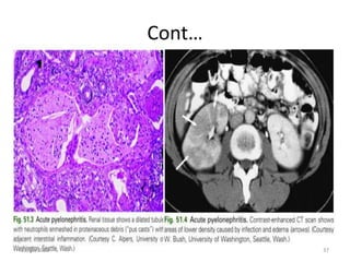 Cont…
12/30/2022 37
 