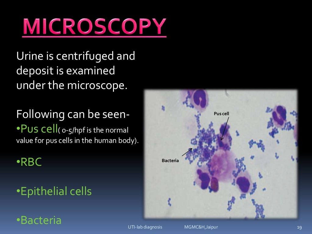 urinary tract infectionsLab diagnosis (e.coli, klebsilla, proteus, p…