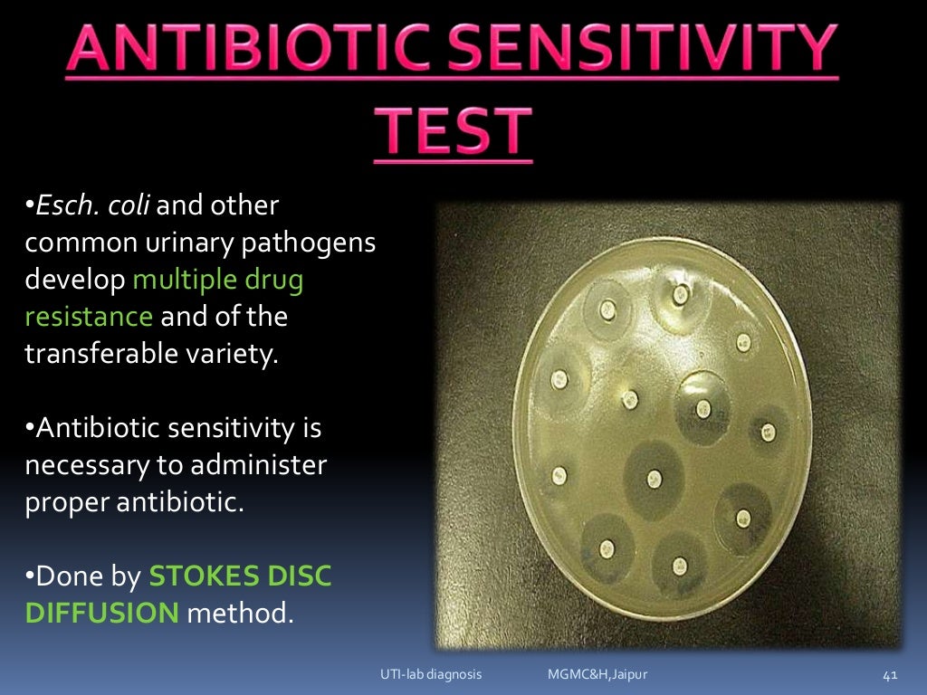 urinary tract infectionsLab diagnosis (e.coli, klebsilla, proteus, p…