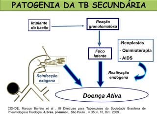 Implante
do bacilo
Foco
latente
Reação
granulomatosa
Reinfecção
exógena
Reativação
endógena
Doença Ativa
-Neoplasias
- Quimioterapia
- AIDS
PATOGENIA DA TB SECUNDÁRIA
CONDE, Marcus Barreto et al . III Diretrizes para Tuberculose da Sociedade Brasileira de
Pneumologia e Tisiologia. J. bras. pneumol., São Paulo , v. 35, n. 10, Oct. 2009 .
 