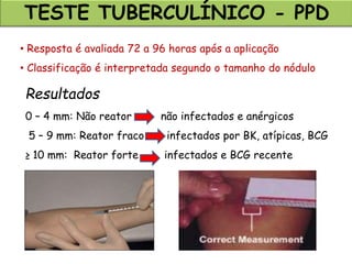 TESTE TUBERCULÍNICO - PPD
• Resposta é avaliada 72 a 96 horas após a aplicação
• Classificação é interpretada segundo o tamanho do nódulo
Resultados
0 – 4 mm: Não reator não infectados e anérgicos
5 – 9 mm: Reator fraco infectados por BK, atípicas, BCG
≥ 10 mm: Reator forte infectados e BCG recente
 