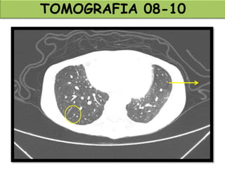 TOMOGRAFIA 08-10
 