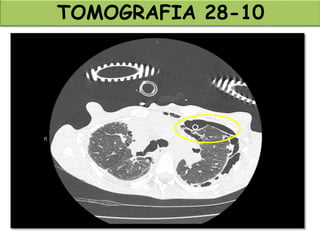 TOMOGRAFIA 28-10
 