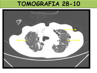 TOMOGRAFIA 28-10
 