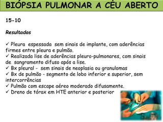 BIÓPSIA PULMONAR A CÉU ABERTO
15-10
Resultados
 Pleura espessada sem sinais de implante, com aderências
firmes entre pleura e pulmão.
 Realizada lise de aderências pleuro-pulmonares, com sinais
de sangramento difuso após a lise.
 Bx pleural - sem sinais de neoplasia ou granulomas
 Bx de pulmão - segmento de lobo inferior e superior, sem
intercorrências
 Pulmão com escape aéreo moderado difusamente.
 Dreno de tórax em HTE anterior e posterior
 