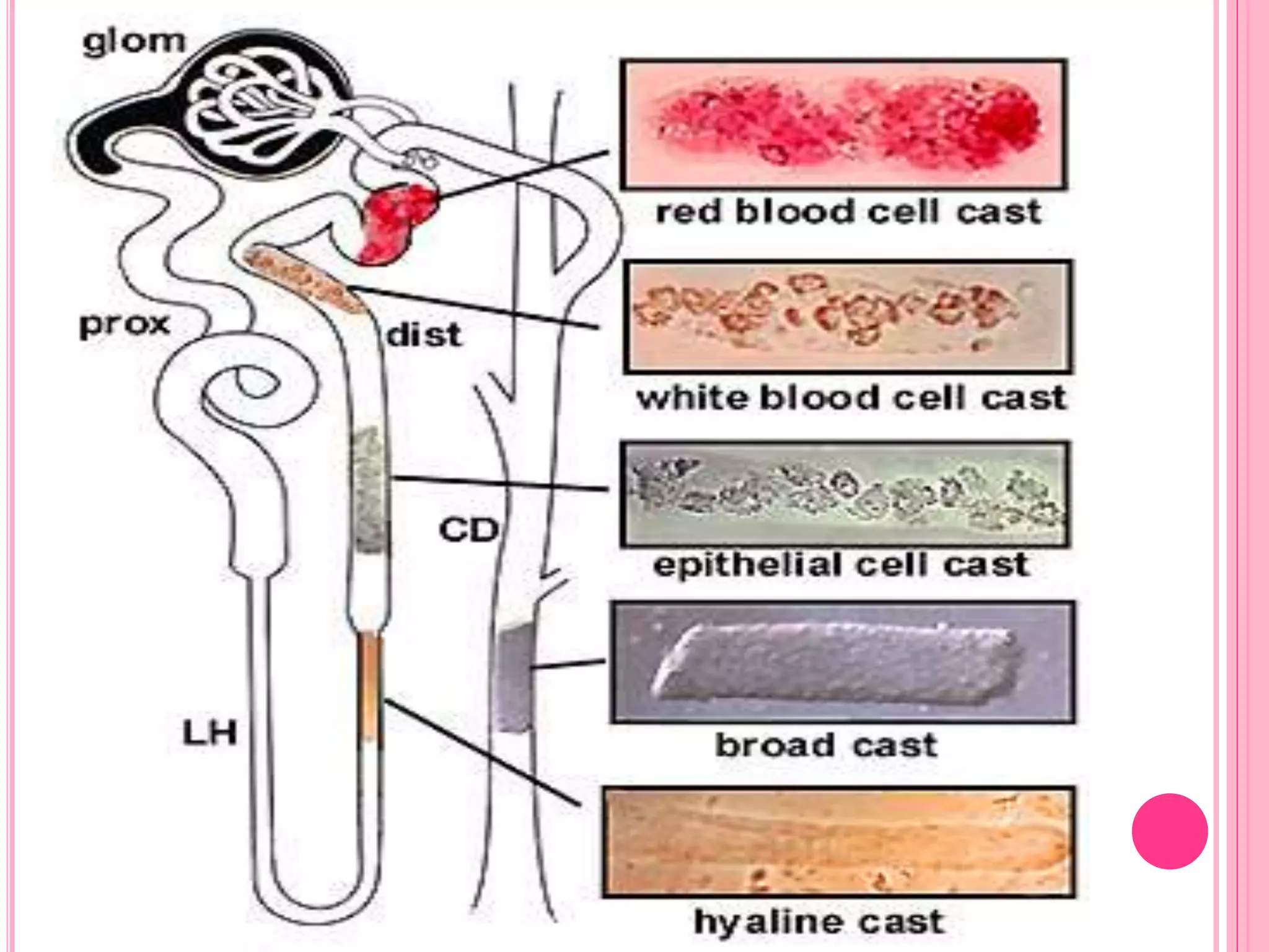 Lab Values For Uti Uti and lab diagnosis | PPTX