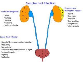 Acute Pyelonephritis
Lower Tract Infection
Symptoms of Infection
Pyonephrosis
Perinephric Abscess
•fever
•malaise
•nausea
•vomiting
•abdominal pain
•rigors
•loin pain
•scoliosis
•loin swelling
•weight loss
•night sweats
•Dysuria/discomfort during urinating
•frequency
•haematuria
•Nocturia/frequent urination at night
•suprapubic pain
•urgency
•foul urine
 