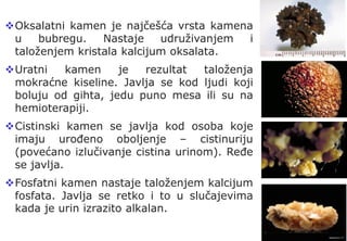 Uticaj pH urina na nastanak kamena u bubregu | PDF