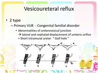 Vesicoureteral reflux
• 2 type
– Primary VUR - Congenital familial disorder
• Abnormalities of ureterovesical junction
 lateral and cephalad displacement of ureteric orifice
+ Short intramural ureter “ Golf hole “
 