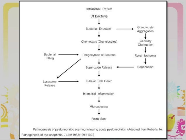 discussion essay structure simon