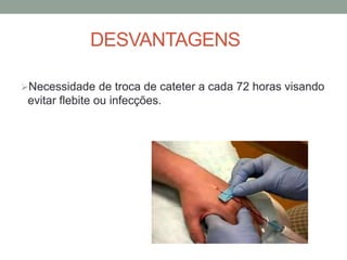 DESVANTAGENS
Necessidade de troca de cateter a cada 72 horas visando
evitar flebite ou infecções.
 