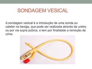 SONDAGEM VESICAL
A sondagem vesical é a introdução de uma sonda ou
cateter na bexiga, que pode ser realizada através da uretra
ou por via supra púbica, e tem por finalidade a remoção da
urina.
 