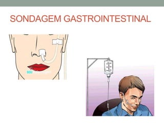 SONDAGEM GASTROINTESTINAL
 